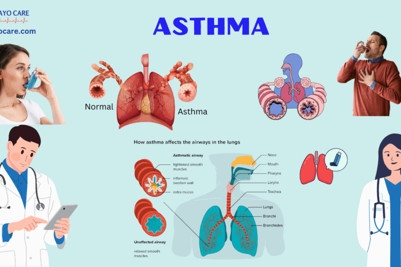 Asthma: Causes, Symptoms, Diagnosis & Treatments