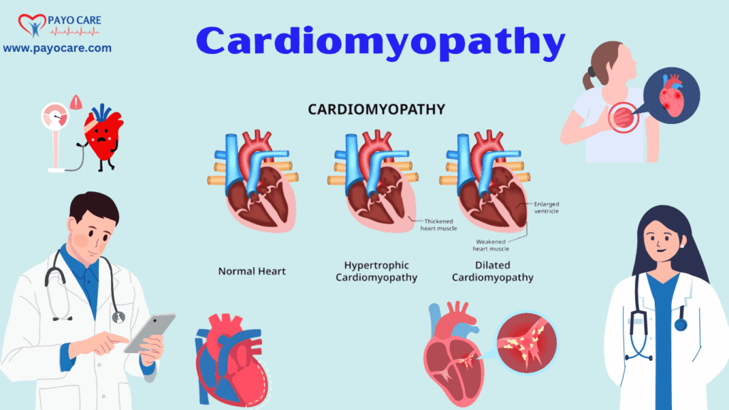 Cardiomyopathy :Types, Causes, Symptoms, Prevention, Diagnosis & Treatment .Cardiomyopathy :Types, Causes, Symptoms, Prevention, Diagnosis & Treatment