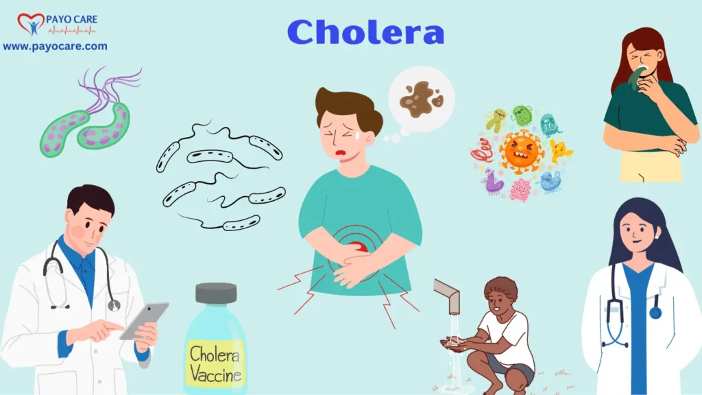 Cholera: Types, Causes, Symptoms, Prevention, Diagnosis, and Treatments 