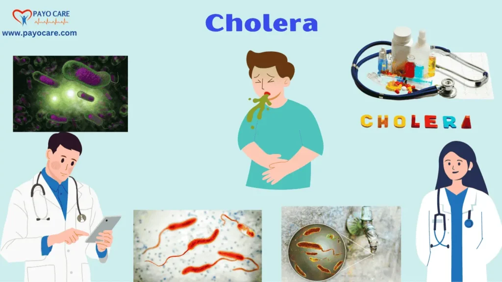 Cholera: Types, Causes, Symptoms, Prevention, Diagnosis, and Treatments – The Ultimate Guide