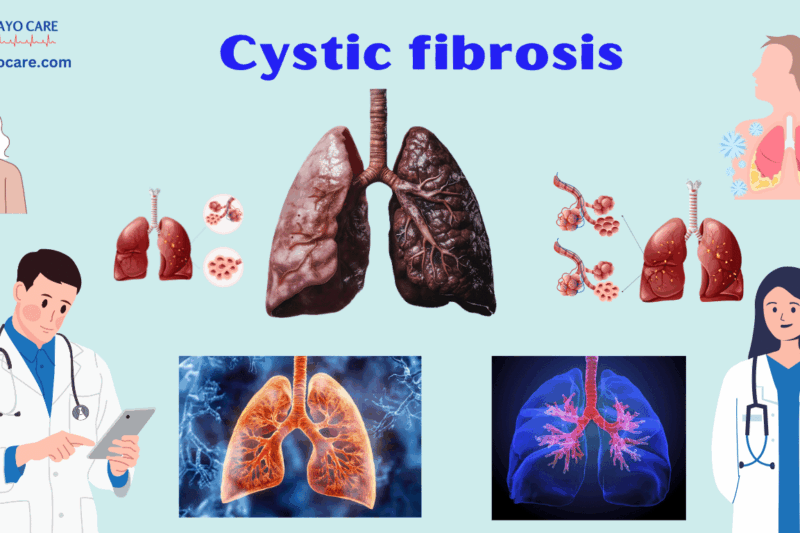Cystic Fibrosis: Causes, Symptoms, Prevention & Treatment