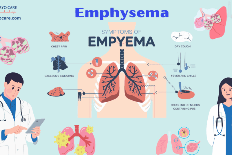 Emphysema: Causes, Symptoms & Treatment