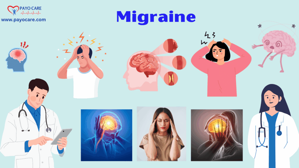 Migraines: Types, Causes, Symptoms, Prevention, Diagnosis & Treatment Migraines: Types, Causes, Symptoms, Prevention, Diagnosis & Treatment