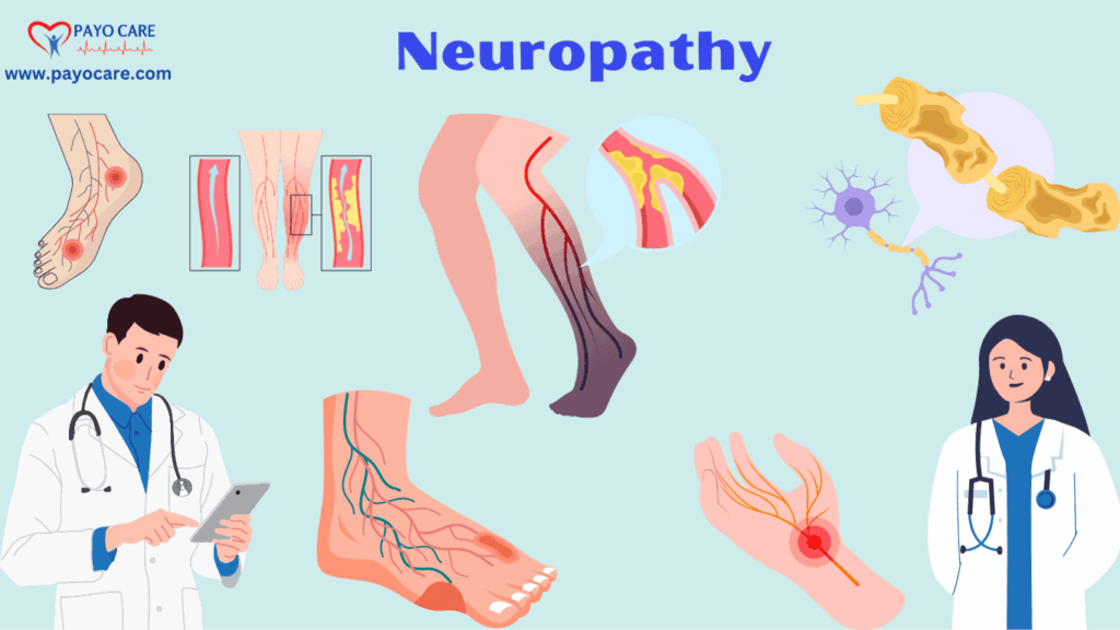 Neuropathy: Types, Causes, Symptoms, Prevention