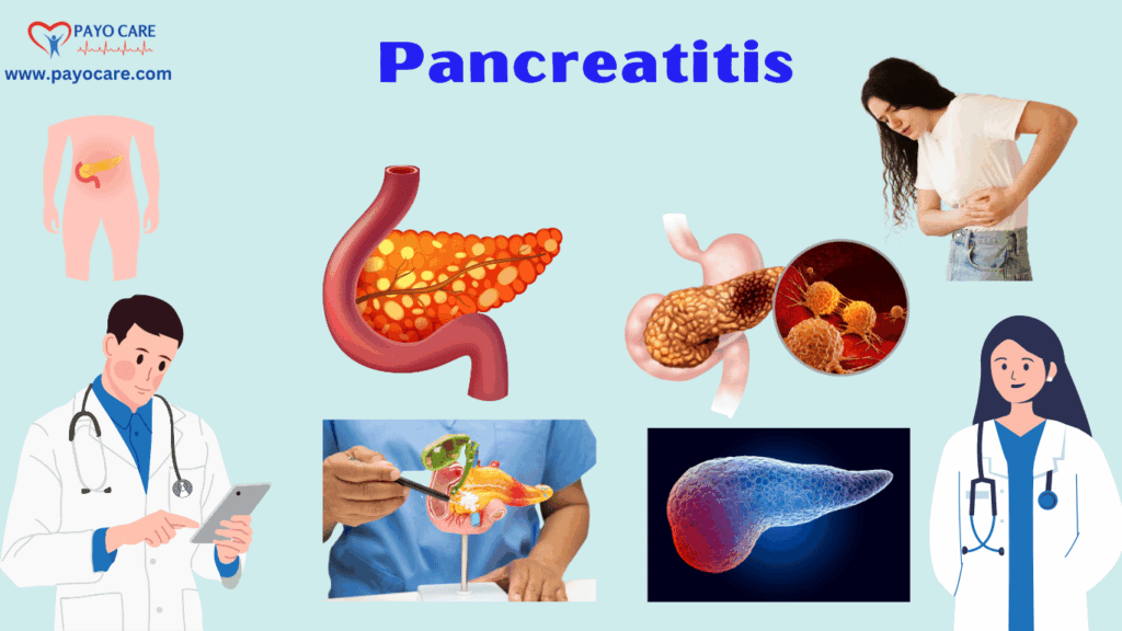 Pancreatitis:Types, Causes, Symptoms, Prevention, Diagnosis & Treatment