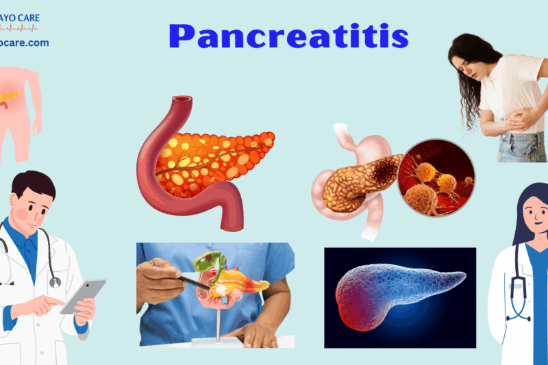 Pancreatitis:Causes, Symptoms, Prevention & Treatment