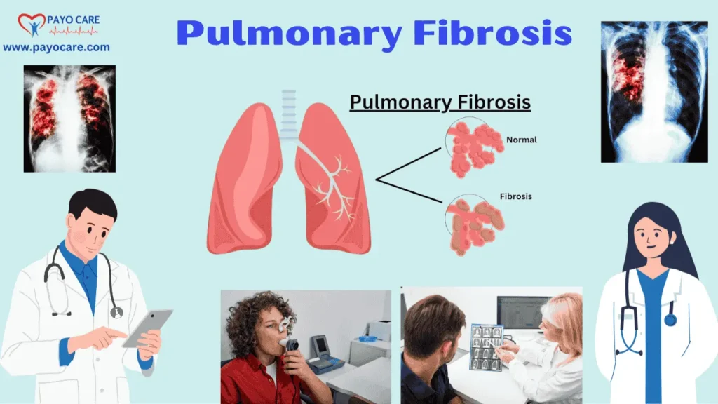 Pulmonary Fibrosis (1)