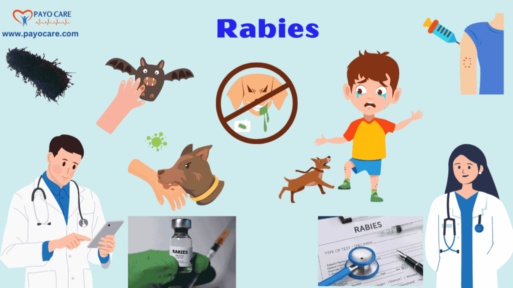 Rabies :Types, Causes, Symptoms, Prevention, Diagnosis & Treatment