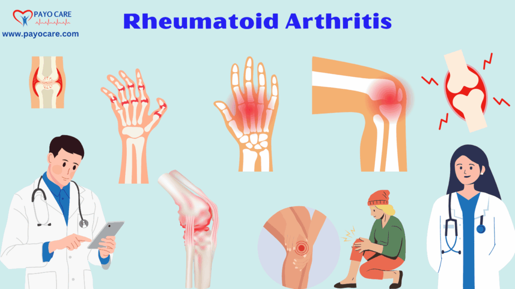 Rheumatoid Arthritis :Types, Causes, Symptoms, Prevention, Diagnosis & Treatment