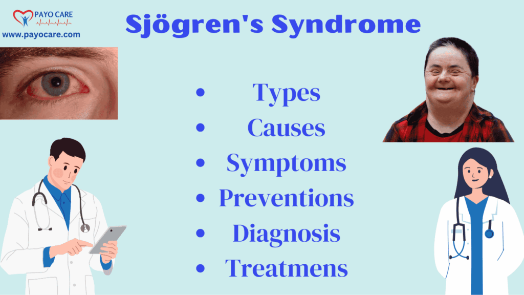 Sjögren's Syndrome: Types, Causes, Symptoms, Prevention, Diagnosis, and Treatments