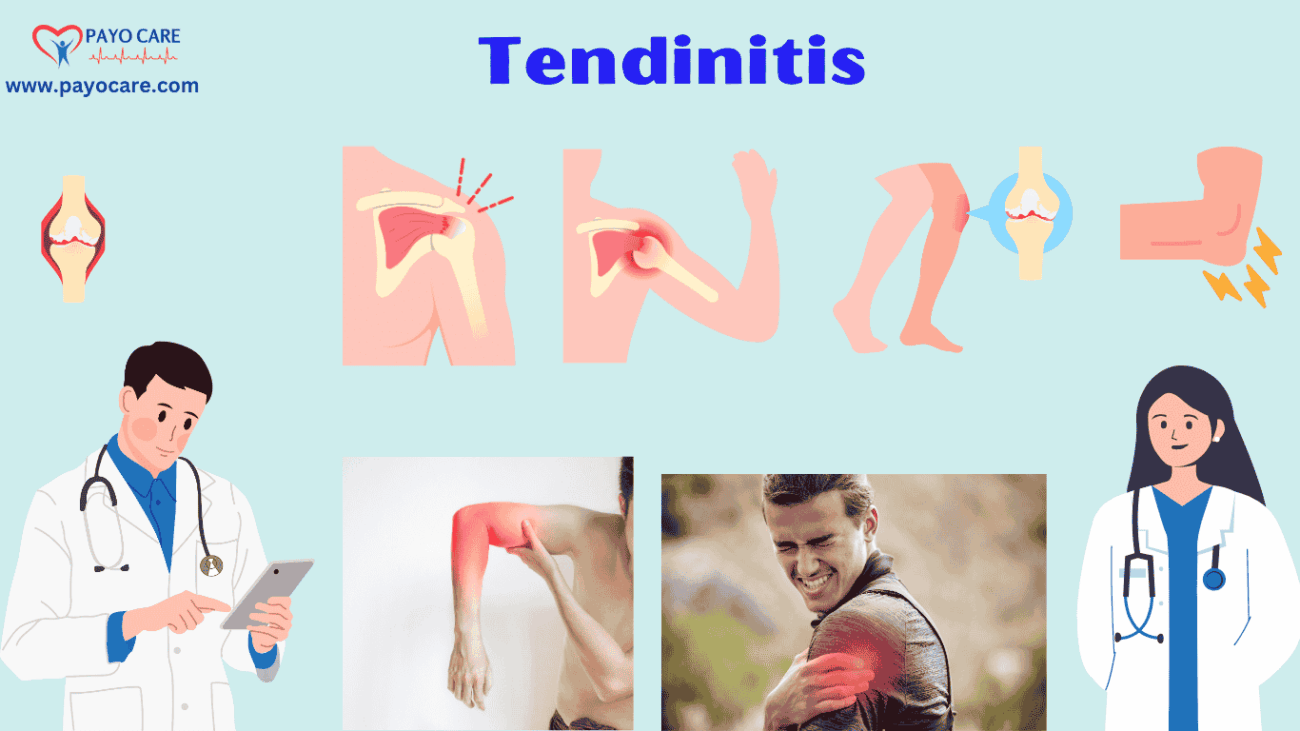 Tendinitis: Types, Causes, Symptoms, Prevention, Diagnosis & Treatment