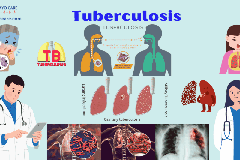 Tuberculosis: Causes, Symptoms, Prevention, & Treatment