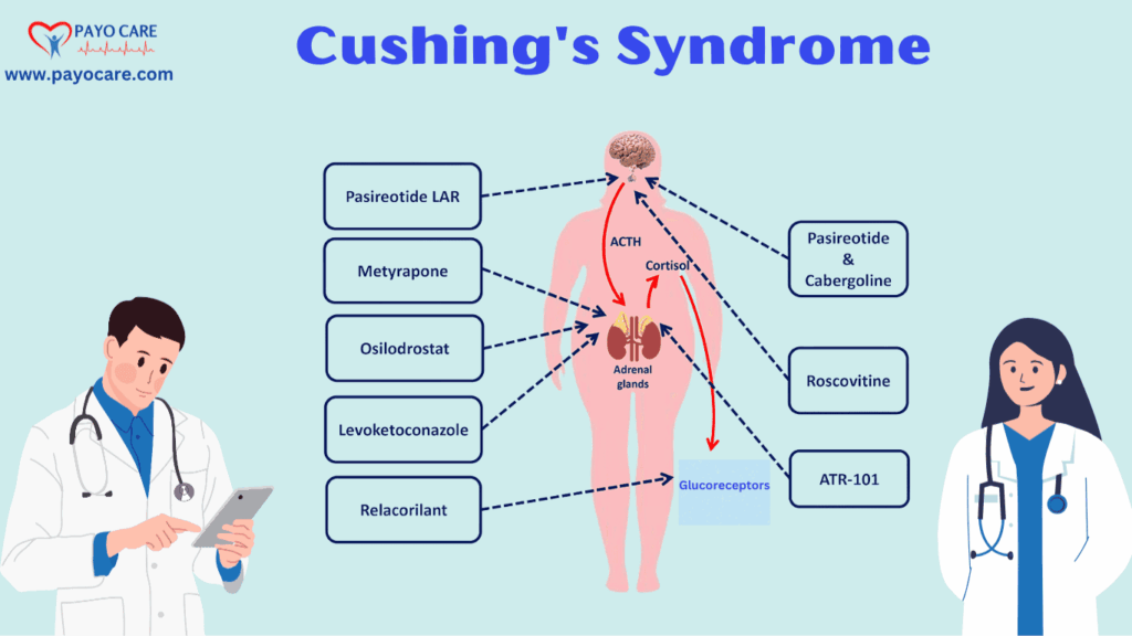 Cushing’s Syndrome: Types, Causes, Symptoms, Prevention, Diagnosis, and Treatment Cushing’s Syndrome: Types, Causes, Symptoms, Prevention, Diagnosis, and Treatment