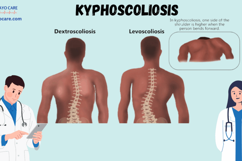 Kyphoscoliosis: Causes, Symptoms, Prevention, Diagnosis, and Treatment